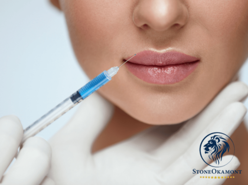 How to register hyaluronic acid in Brazil?