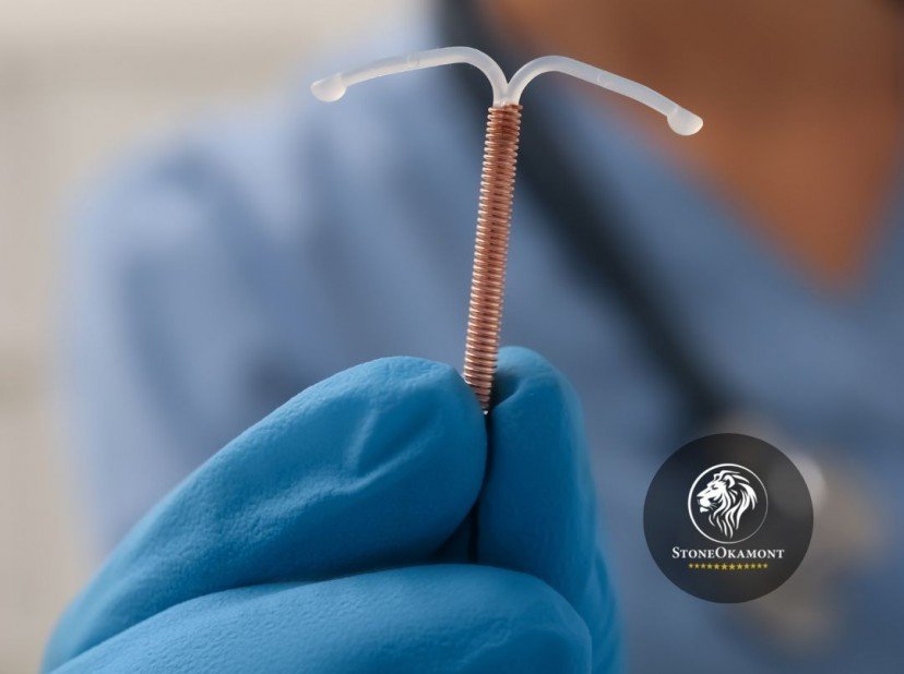 How to register IUD at ANVISA?